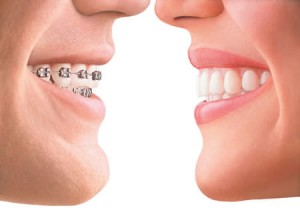 Ortodontie Iasi la cabinet stomatologic Iasi Anatomic Dent